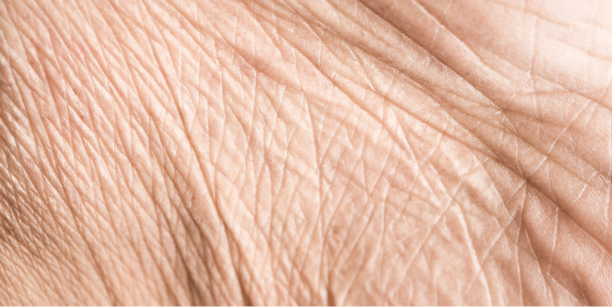 Epidermis and Dermaviduals